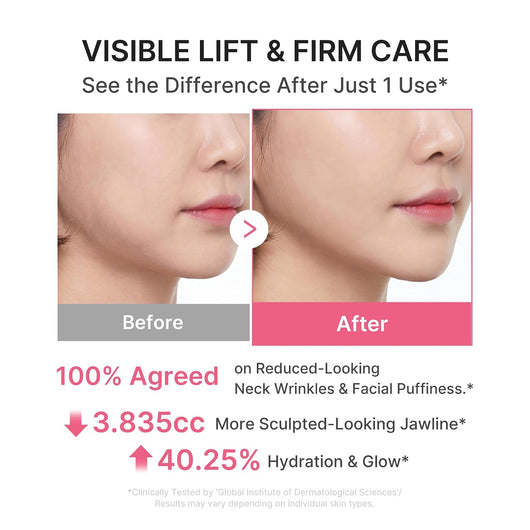 Aureska PDRN Collagen Gua Sha Neck Wrinkle Cream